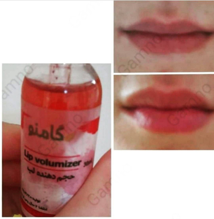 لوسیون حجم دهنده لب گامنو