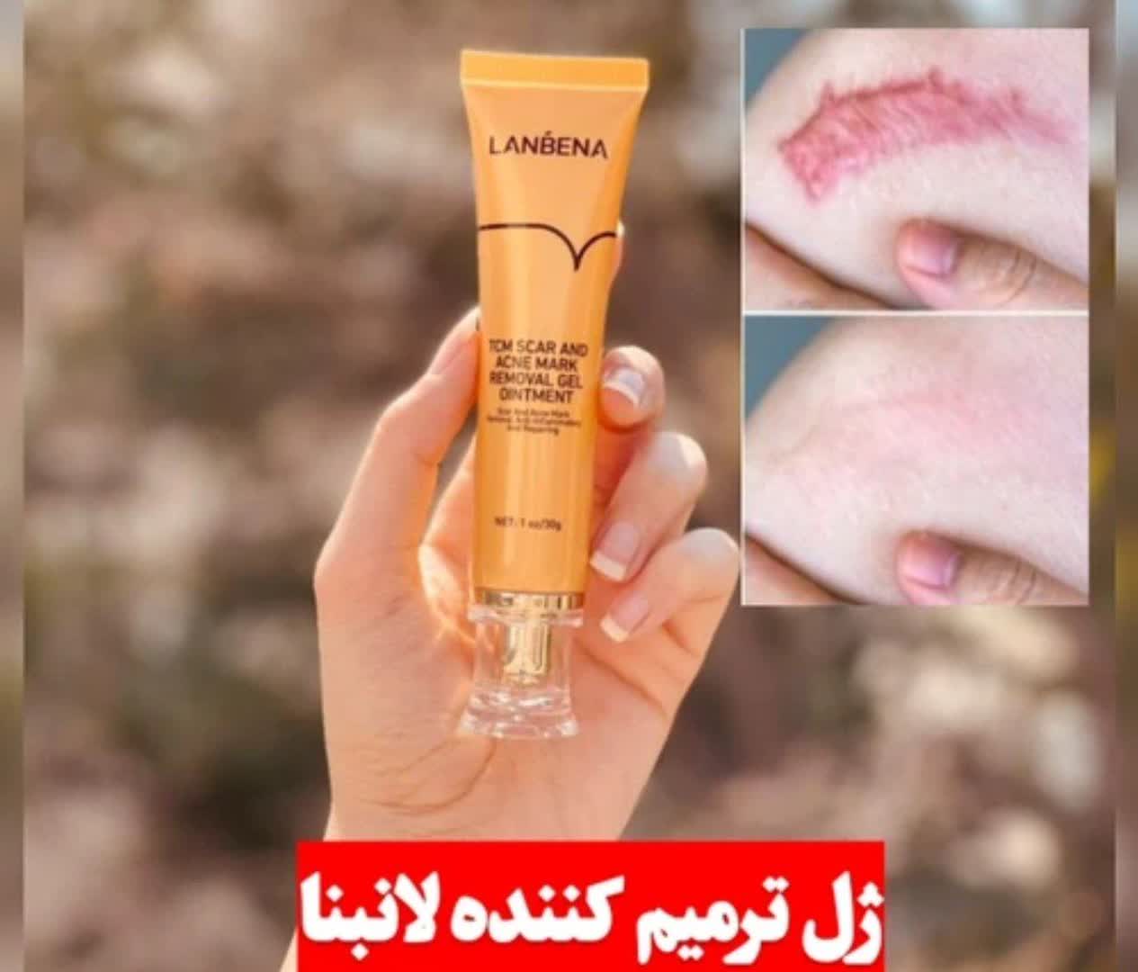ژل ترمیمی زخم و‌اسکار لانبنا
