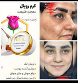 کرم سفید کننده ضدلک وجوانساز ژل رویال