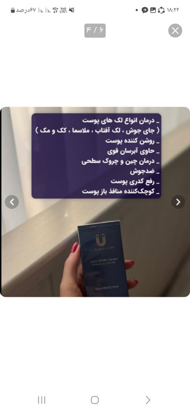 کرمضدلک و روشن کنننده جهانی لاکچری کویین
