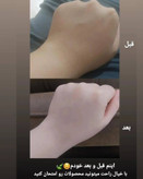 کرم سفید کننده کل بدن وی ای پی اصل اصل عمده کف قیمت