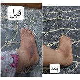 کرم سفید کننده کل بدن وی ای پی اصل اصل عمده کف قیمت