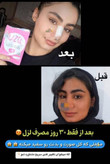 قرص سفید کننده کل بدن لزل
