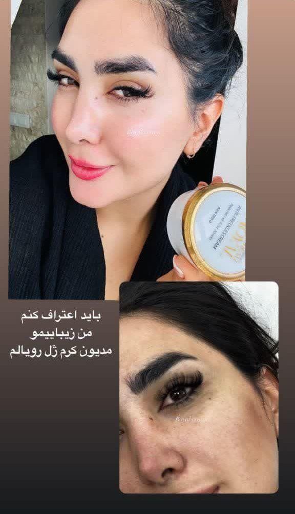 کرم سفید کننده ضدلک وجوانساز ژل رویال