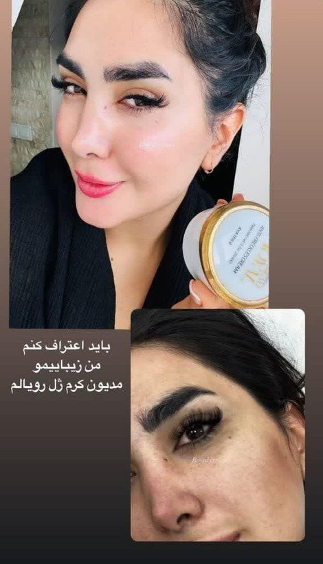 کرم سفید کننده ضدلک وجوانساز ژل رویال
