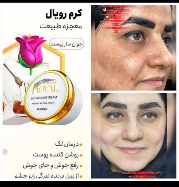 کرم ژل رویال سفید کننده ضدلک وجوانساز ژل رویال اصل بارکد دار عمده کف قیمت