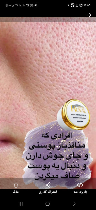 کرم ژل رویال سفید کننده ضدلک وجوانساز ژل رویال اصل بارکد دار عمده کف قیمت