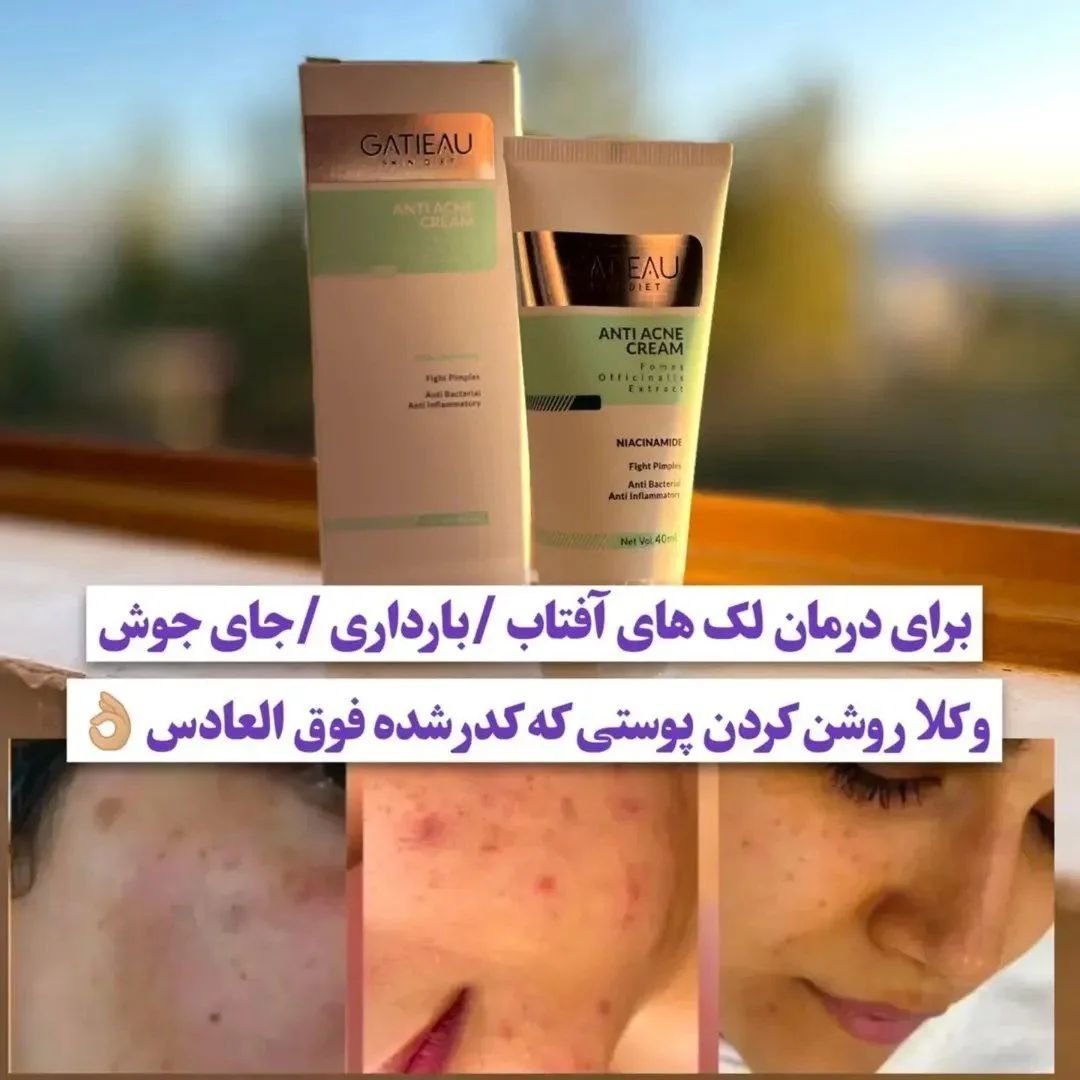 ضدآفتاب گاتیو کیفیت اصلی و تضمینی