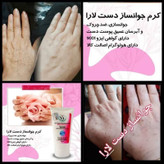 کرم جوانساز دست یارا