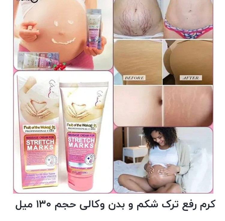 کرمترکبدن وکالی