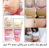 کرمترکبدن وکالی