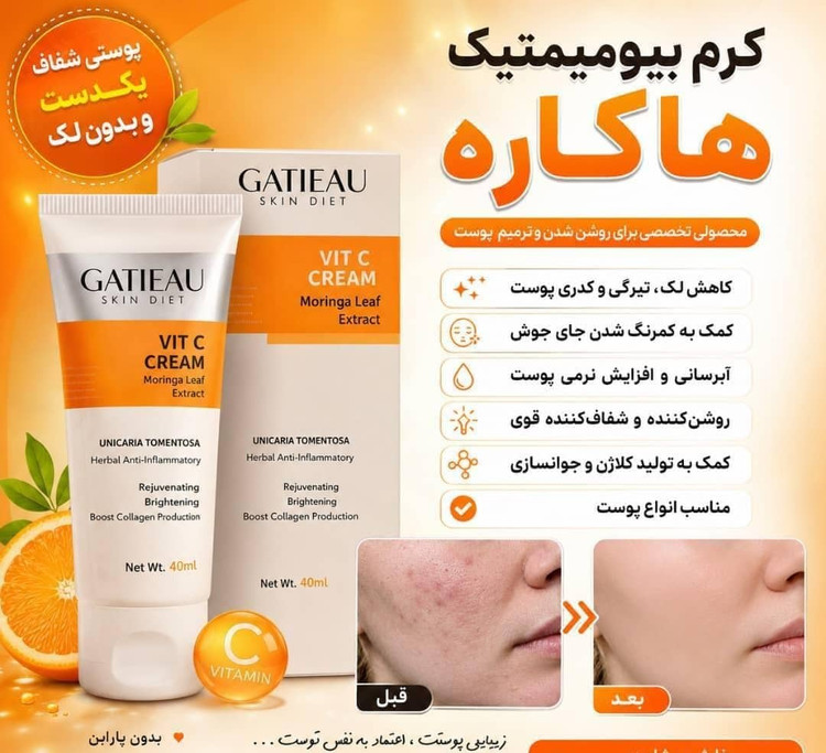 کرم بیوممتیک گاتیو ضدچروک و جوانساز جهانی +کرم بیوممتیک ضدلک و روشن کننده جهانی ۱۵کاره