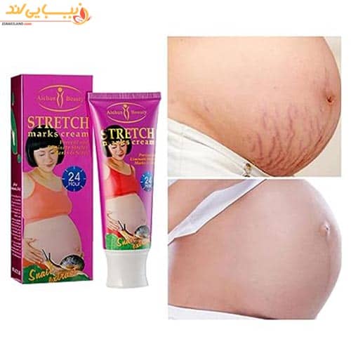 کرم‌گیاهی رفع ترک های بارداری و هر گونه ترک  ایچون بیوتی