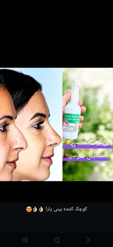 ژلکوچککننده بینی یارا کیفیت عالی