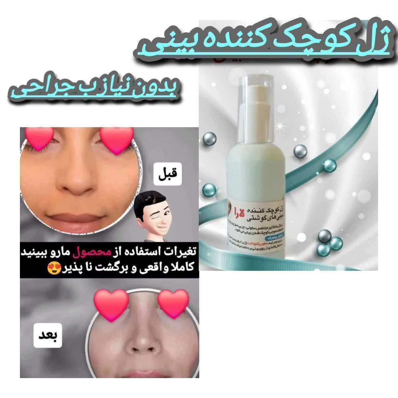 ژل‌کوچک‌کننده بینی یارا کیفیت عالی