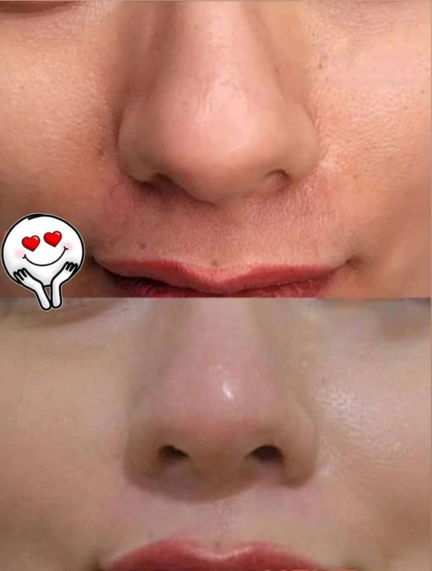 ژلکوچککننده بینی یارا کیفیت عالی