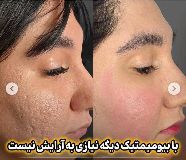 کرم ضدلک عالیییی جهانی بیوممتیک اصل اصل بارکد دار
