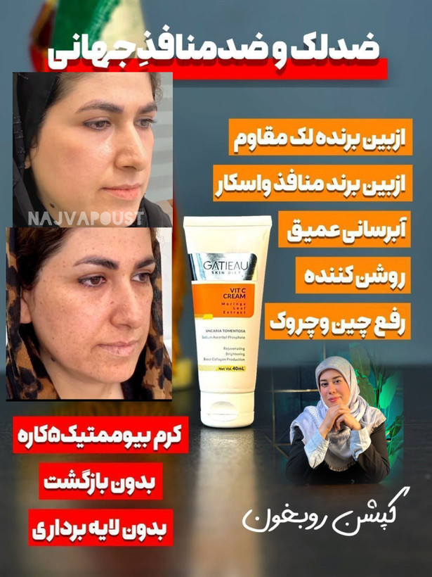 کرم ضدلک عالیییی جهانی بیوممتیک اصل اصل بارکد دار