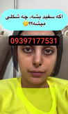 پکسفید کننده کل بدن قرص سفیدکننده لزل به همراه قرص سفیدکننده کل بدن اینفینتی