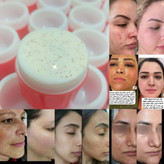 کرم وی ای پی اماراتی درجه یک سفید کننده وضدلک و ضدجوش صورت. عمده کف قیمت