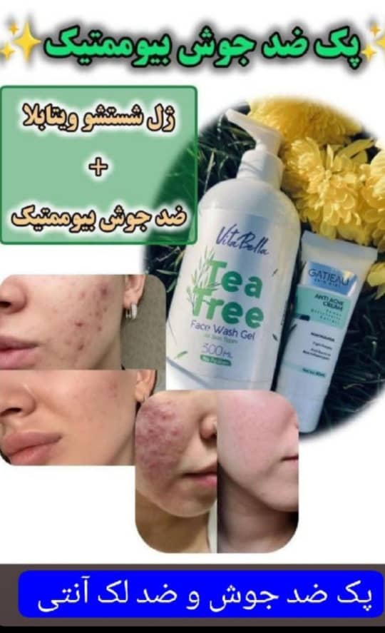پک‌ضدجوش بیوممتیک  ژل شستشو ویتابلا+ضدجوش بیوممتیک