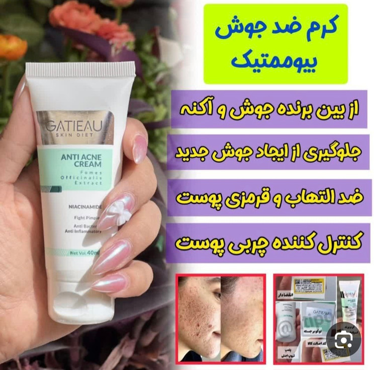کرم ضدجوش بیوممتیک گاتیو اصل بارکد دار