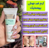 پکضدجوش بیوممتیک ژل شستشو ویتابلا+ضدجوش بیوممتیک
