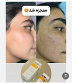 کرم ضدلک عالیییی جهانی بیوممتیک اصل اصل بارکد دار