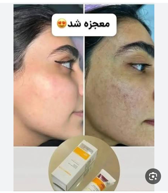 کرم ضدلک عالیییی جهانی بیوممتیک اصل اصل بارکد دار